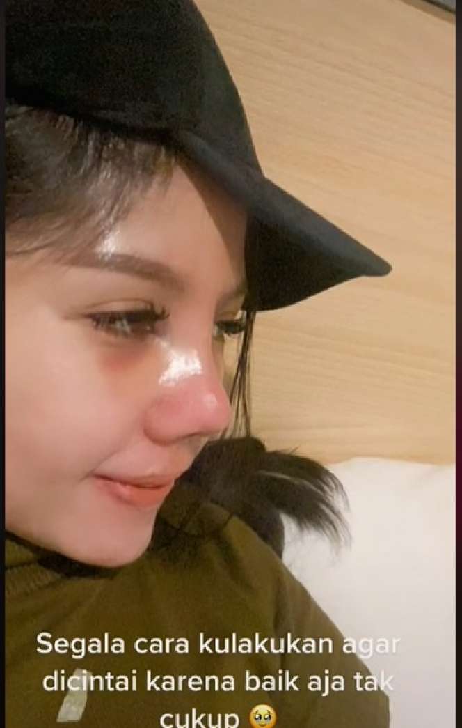 Potret Wanita yang Lakukan Oplas karena Insecure, Transformasinya Bikin Melongo!