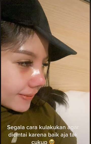 Potret Wanita yang Lakukan Oplas karena Insecure, Transformasinya Bikin Melongo!