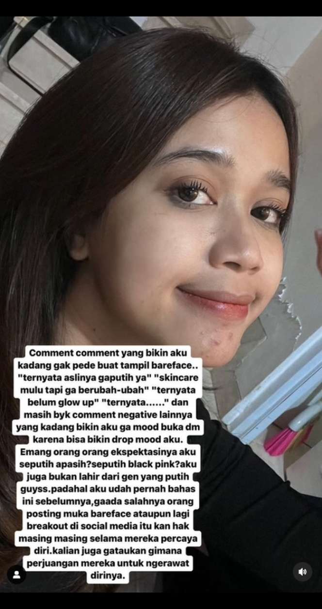 Potret Brisia Jodie Unggah Foto Bareface Tanpa Filter, Berujung Sakit Hati Karena Dibully Netizen!