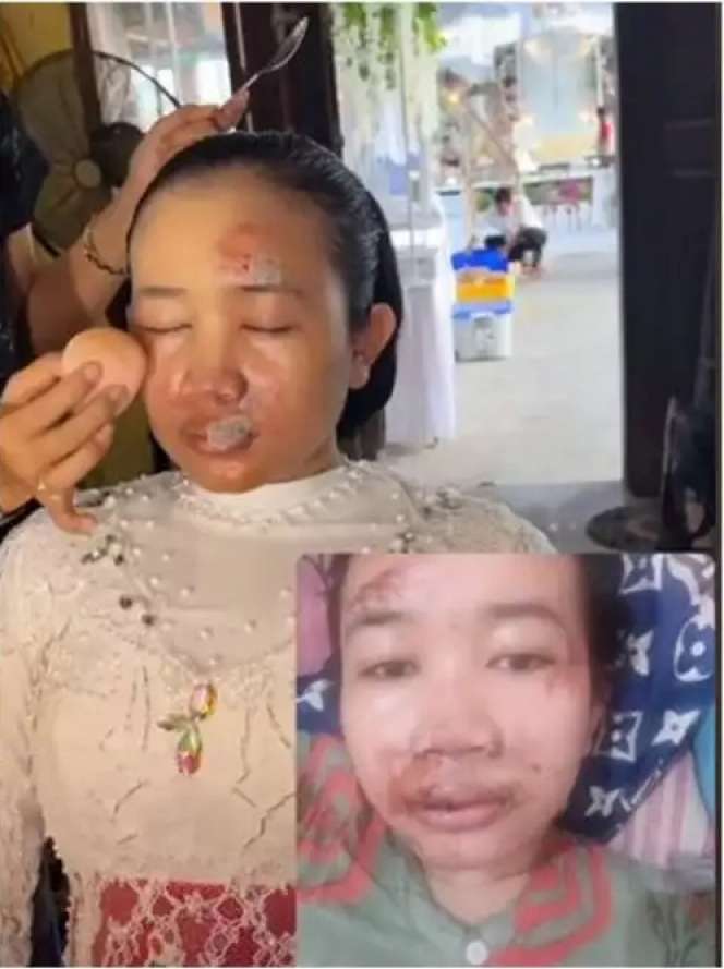 Wajah Bonyok Parah Jelang Nikah, Hasil Makeup Pengantin ini Bikin Melongo, Lihat 7 Potretnya