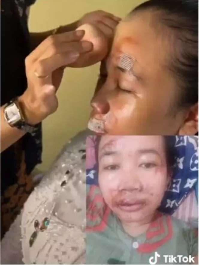 Wajah Bonyok Parah Jelang Nikah, Hasil Makeup Pengantin ini Bikin Melongo, Lihat 7 Potretnya