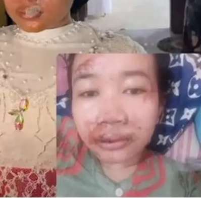 Wajah Bonyok Parah Jelang Nikah, Hasil Makeup Pengantin ini Bikin Melongo, Lihat 7 Potretnya