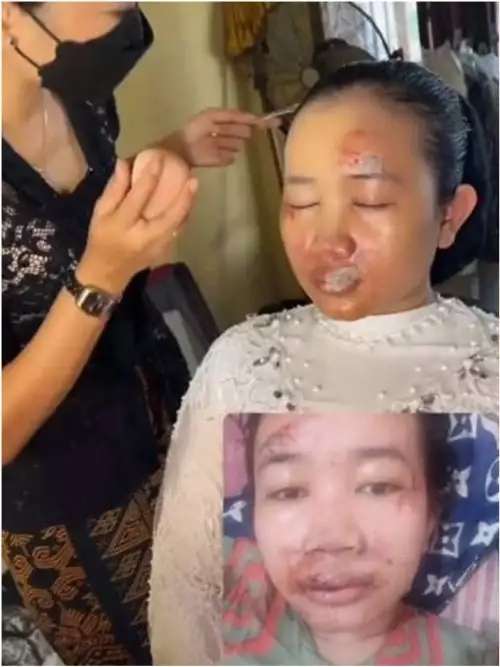 Wajah Bonyok Parah Jelang Nikah, Hasil Makeup Pengantin ini Bikin Melongo, Lihat 7 Potretnya