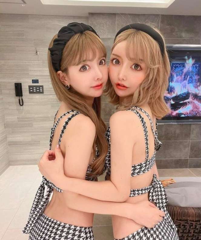 10 Potret Si Kembar yang Oplas Demi Terlihat Identik, Netizen Salfok Foto Before-nya: Beda Banget!