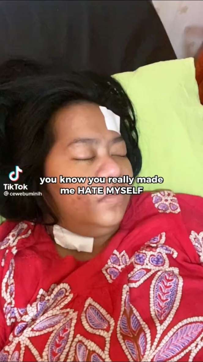 8 Transformasi Wanita Gemuk, Dulu Dihina Mantan Mirip Karung Beras, Kini Auto Nyesal!