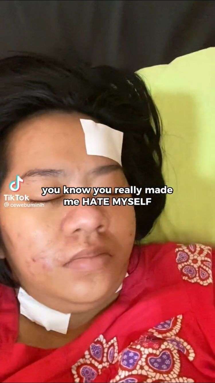 8 Transformasi Wanita Gemuk, Dulu Dihina Mantan Mirip Karung Beras, Kini Auto Nyesal!