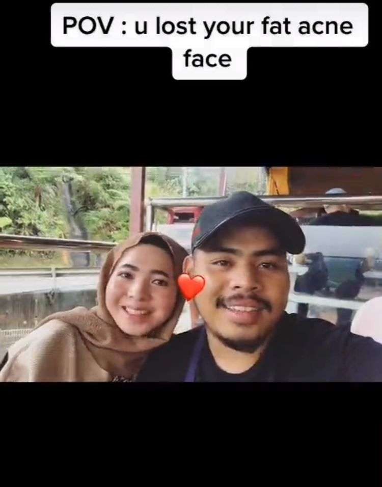 7 Transformasi Wanita Penuh Jerawat Jadi Glow Up Karena Investasi dari Pacar, Bikin Melongo!