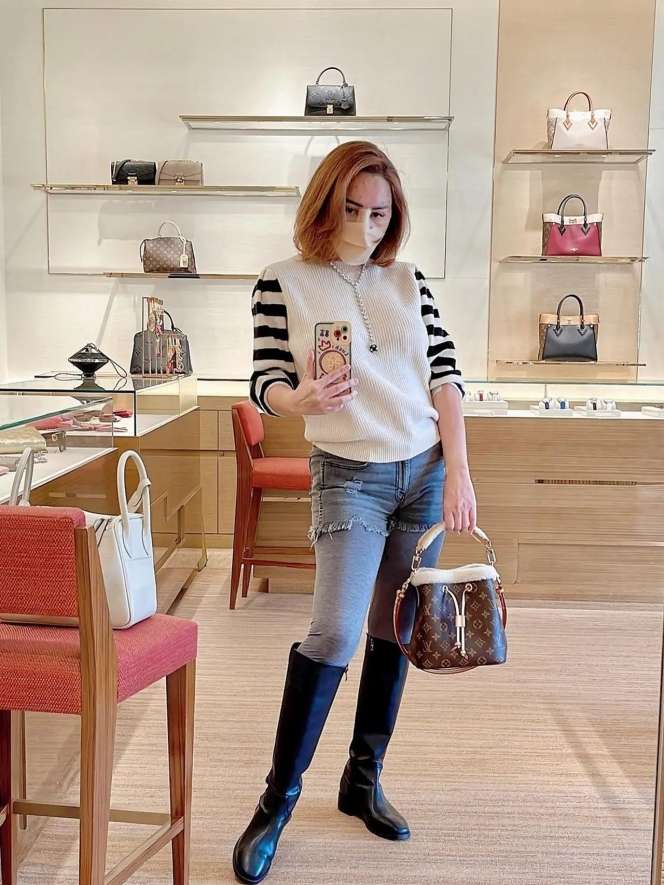 8 Potret Femmy Permatasari Usai Jalani Operasi Plastik `Lagi`, Wajahnya Jadi Beda Banget!