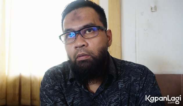 Sempat Tersandung Narkoba Hingga Jadi Pengangguran, Eks Vokalis Band Ini Hijrah, Kini Penampilannya Berubah Drastis!
