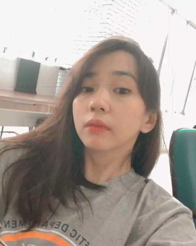 Masih Ingat Ipeh di Sinetron Si Entong? Dulu Gadis Culun, Kini Berubah Bak Idol Korea, Lihat 8 Potretnya