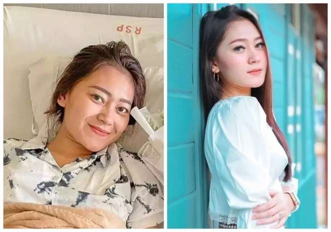 8 Potret Biduan Koplo Pakai VS Tanpa Makeup, Happy Asmara Beda Banget, Netizen Pangling!
