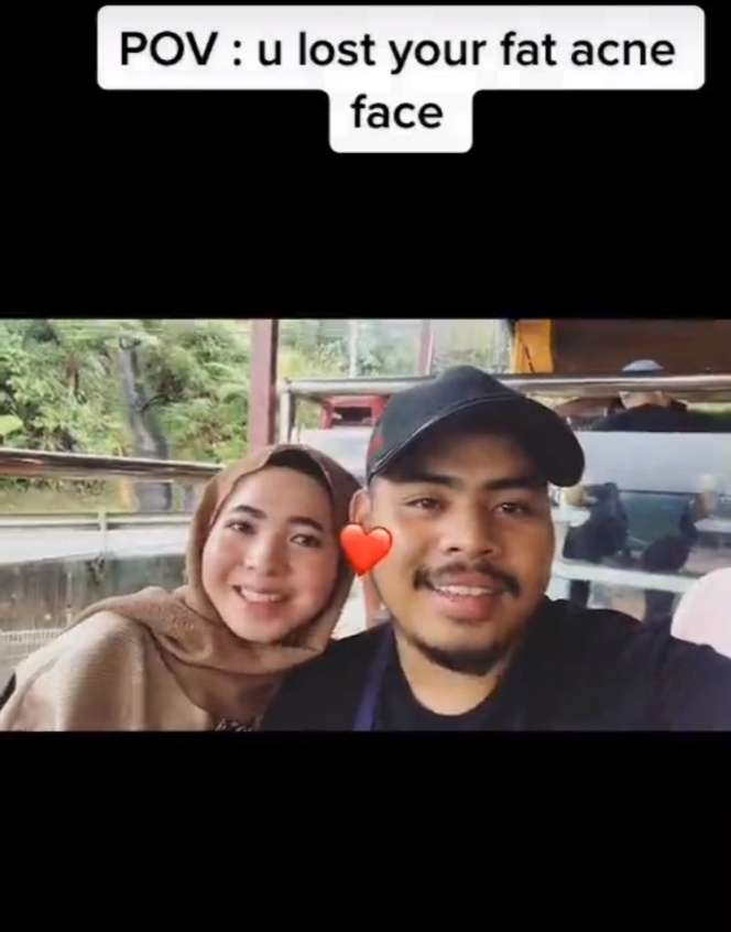 Ingat Wanita Berjerawat yang Dimodali Pacar Rp6,5 Juta Perminggu Agar Cantik? Begini Nasibnya Sekarang