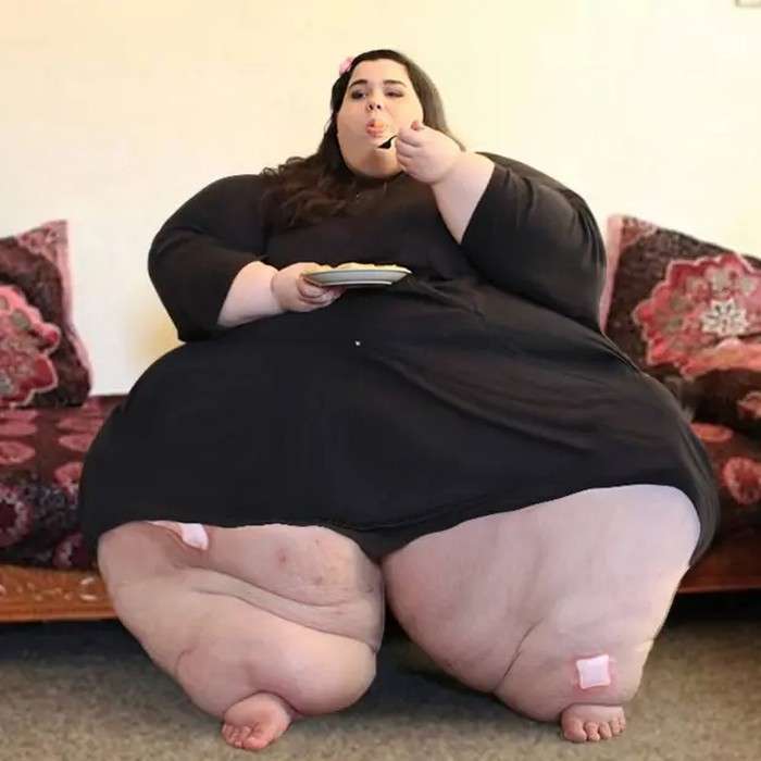 Masih Ingat Wanita Paling Gendut di Dunia dengan Bobot 317 Kg? Dulu Dijuluki Monster, Kini Perubahannya Bikin Pangling