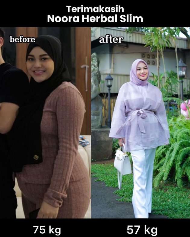 Potret Aurel Hermansyah Usai Turun 18 Kg, Dulu Dicibir Mirip Emak-emak Kini Bungkam Haters dengan Penampilan Baru!