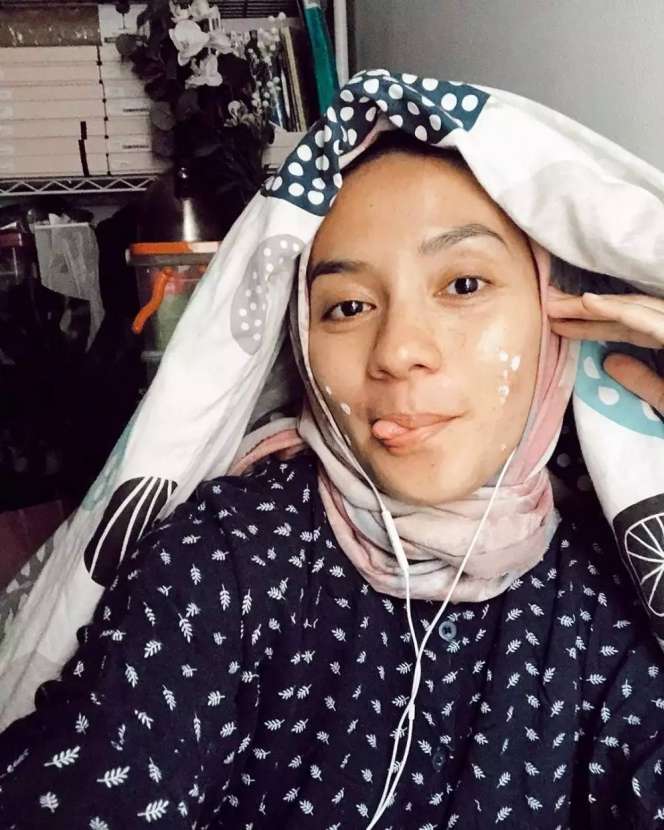 Potret Seleb Pamer Foto Selfie Wajah Penuh Jerawat