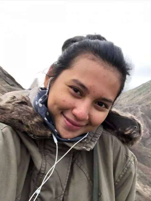 Potret Seleb Pamer Foto Selfie Wajah Penuh Jerawat