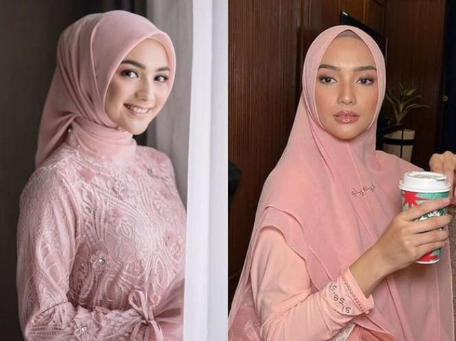 Deretan Seleb yang Disebut Oplas, Wajahnya Terlihat Beda!