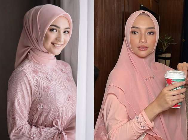 Deretan Seleb yang Disebut Oplas, Wajahnya Terlihat Beda!