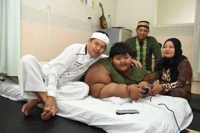 Masih Ingat Arya Permana Bocah Viral Berbobot 190 Kg? Penampilannya Berubah Drastis Usai Operasi & Diet, Bikin Pangling!