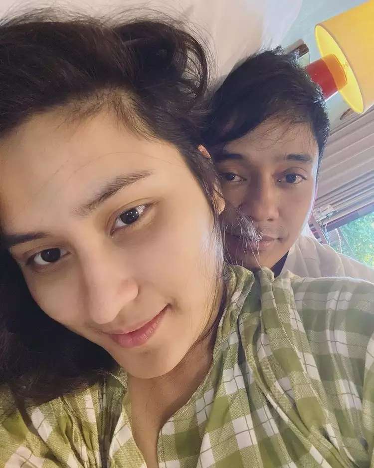 10 Penampilan Asli Artis Saat Tanpa Makeup, Irish Bella Pede Meski Wajahnya Berjerawat!