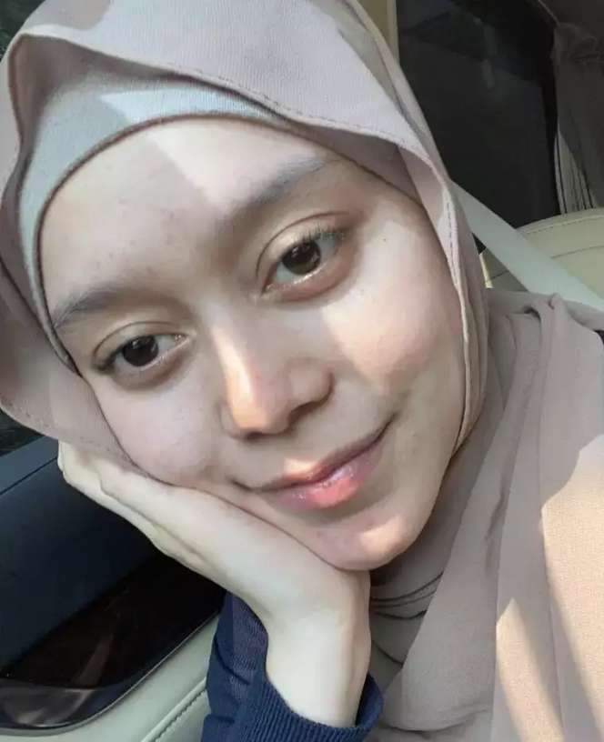 10 Penampilan Asli Artis Saat Tanpa Makeup, Irish Bella Pede Meski Wajahnya Berjerawat!