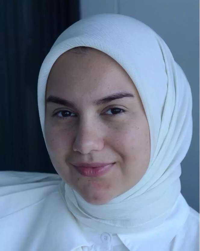 10 Penampilan Asli Artis Saat Tanpa Makeup, Irish Bella Pede Meski Wajahnya Berjerawat!
