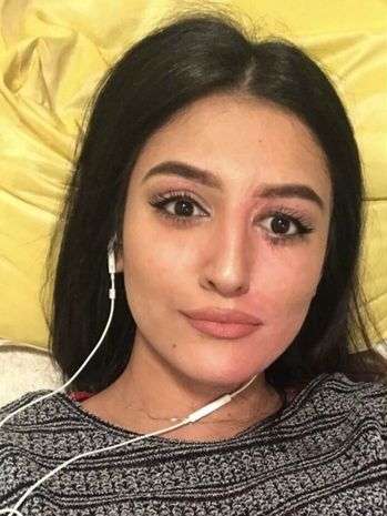 Ingat Artis Cantik yang Disiram Air Keras di Hari Ulang Tahunnya? Wajahnya Dulu Meleleh & Hancur, Penampilannya Kini Bikin Pangling
