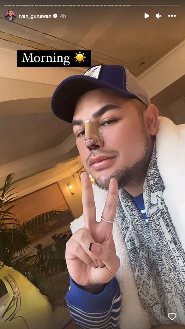 Potret Ivan Gunawan Pamer Hidung Baru Usai Oplas di Turki, Hasilnya Beda Banget!
