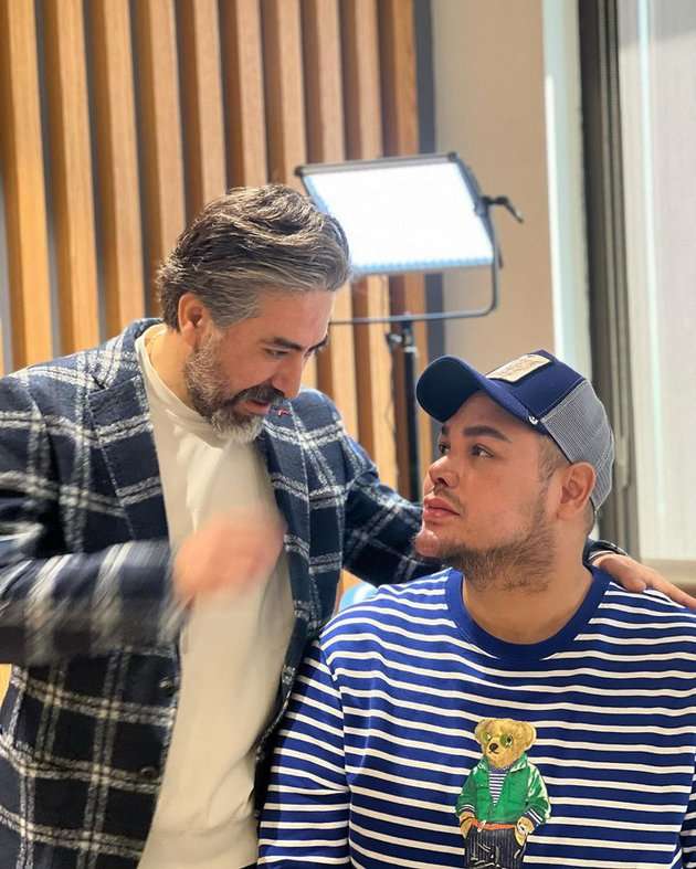 Potret Ivan Gunawan Pamer Hidung Baru Usai Oplas di Turki, Hasilnya Beda Banget!