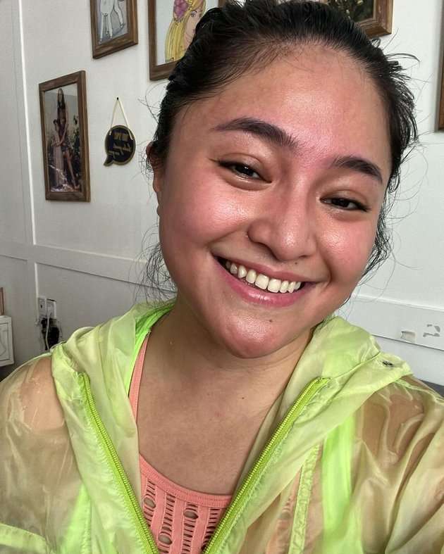 Potret Marshanda Pajang Penampilan Polos Tanpa Riasan