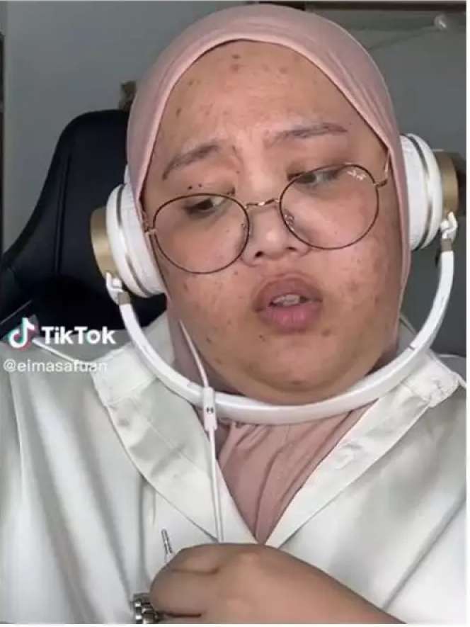 10 Transformasi Makeup Wanita Berjerawat Parah, Jadi Cantik Tirus Bak Boneka Barbie, Bikin Pangling!