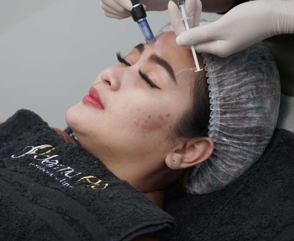 Rutin Melakukan Treatment, Trik Vega Darwanti Agar Suami Menambah Uang Bulanan