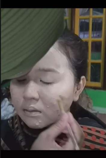 Potret Transformasi Makeup Pengantin yang Alami Jerawat Parah, Hasil Riasannya Bikin Melongo!