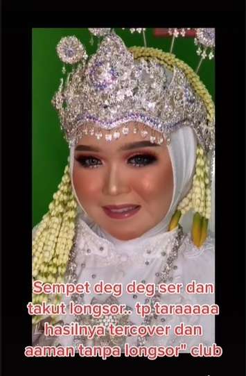 Potret Transformasi Makeup Pengantin yang Alami Jerawat Parah, Hasil Riasannya Bikin Melongo!