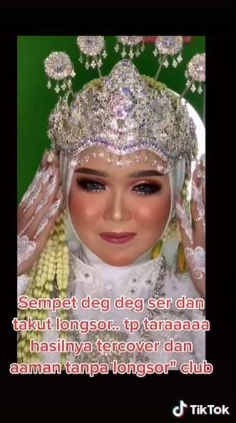 Potret Transformasi Makeup Pengantin yang Alami Jerawat Parah, Hasil Riasannya Bikin Melongo!