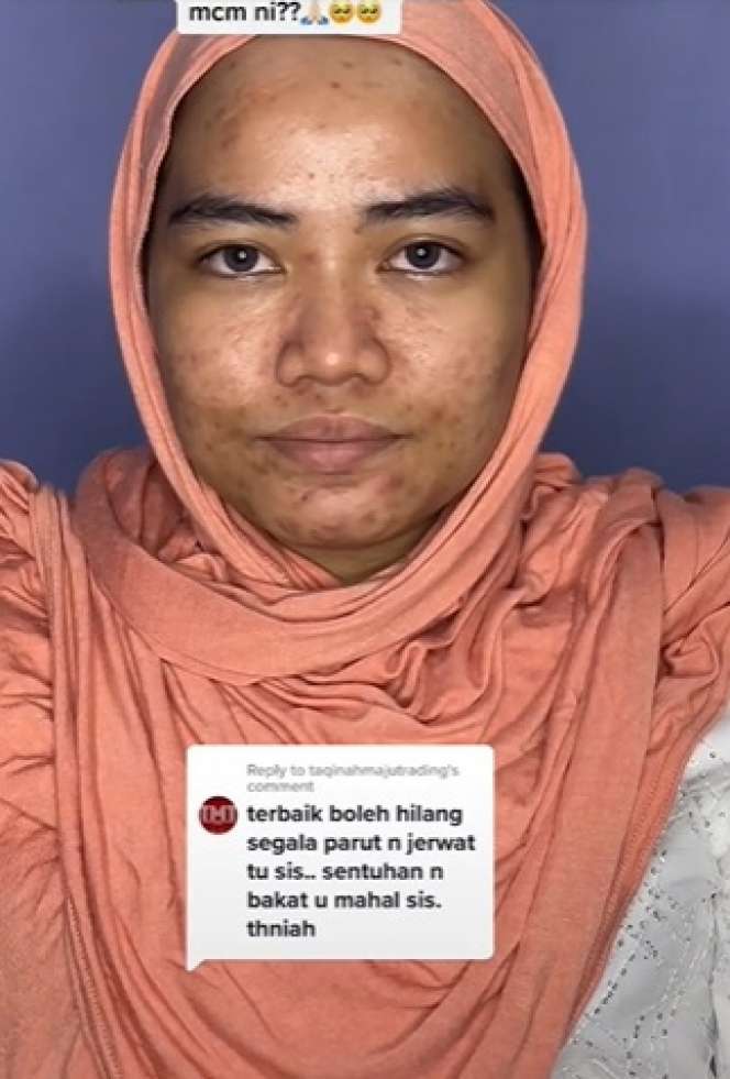 Semula Banyak Jerawat, Potret Pengantin Wanita yang Wajahnya Disulap Seperti Barbie!