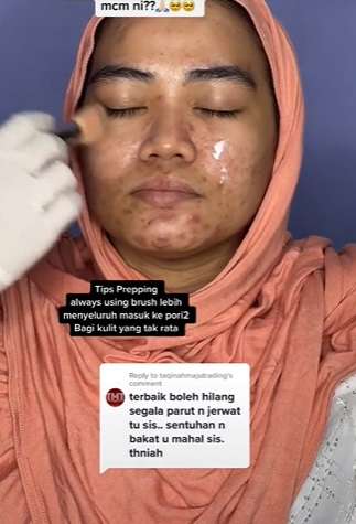 Semula Banyak Jerawat, Potret Pengantin Wanita yang Wajahnya Disulap Seperti Barbie!