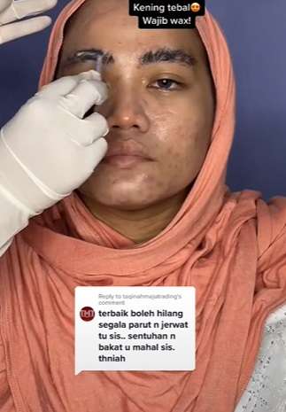 Semula Banyak Jerawat, Potret Pengantin Wanita yang Wajahnya Disulap Seperti Barbie!