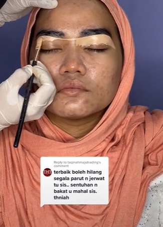 Semula Banyak Jerawat, Potret Pengantin Wanita yang Wajahnya Disulap Seperti Barbie!