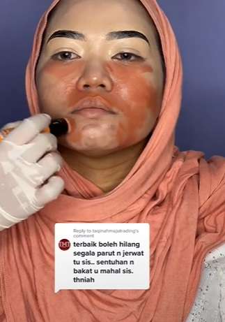 Semula Banyak Jerawat, Potret Pengantin Wanita yang Wajahnya Disulap Seperti Barbie!