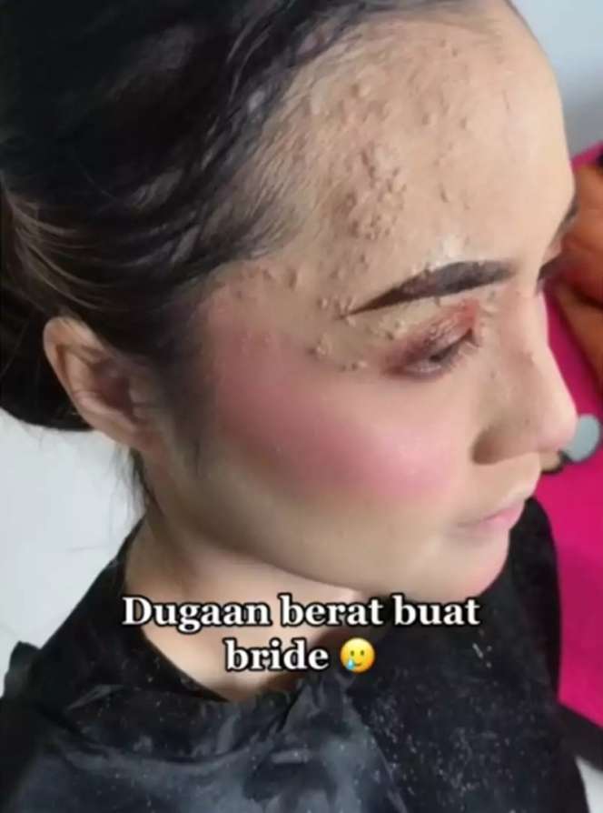 Potret Pengantin Wajahnya Terkena Infeksi Dirias MUA, Hasilnya Bikin Pangling, Mulus Bak Barbie Hidup!