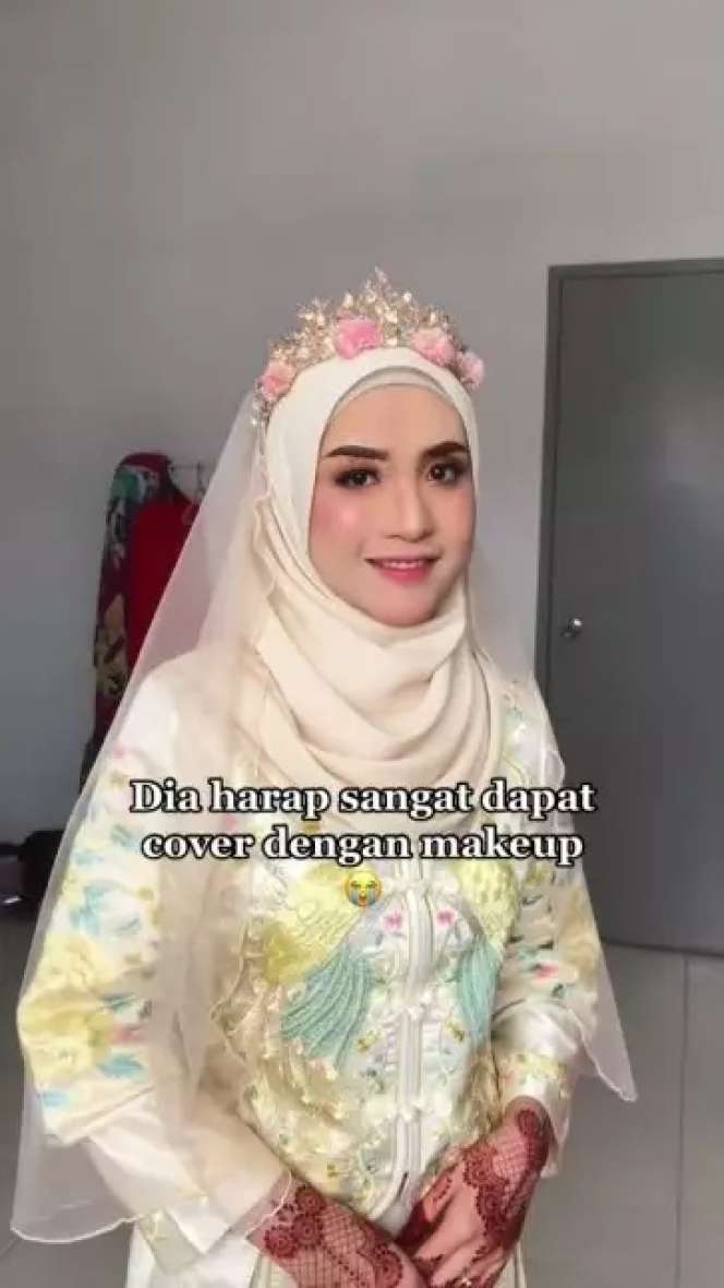 Potret Pengantin Wajahnya Terkena Infeksi Dirias MUA, Hasilnya Bikin Pangling, Mulus Bak Barbie Hidup!
