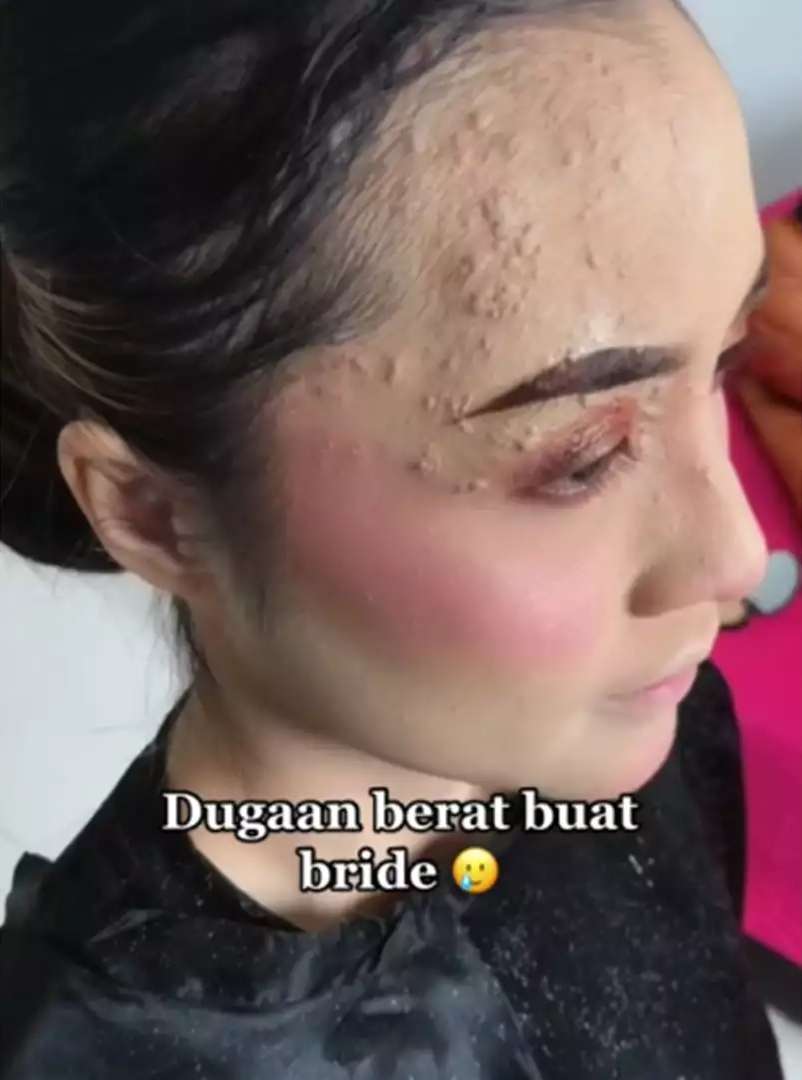 Potret Pengantin Wajahnya Terkena Infeksi Dirias MUA, Hasilnya Bikin Pangling, Mulus Bak Barbie Hidup!