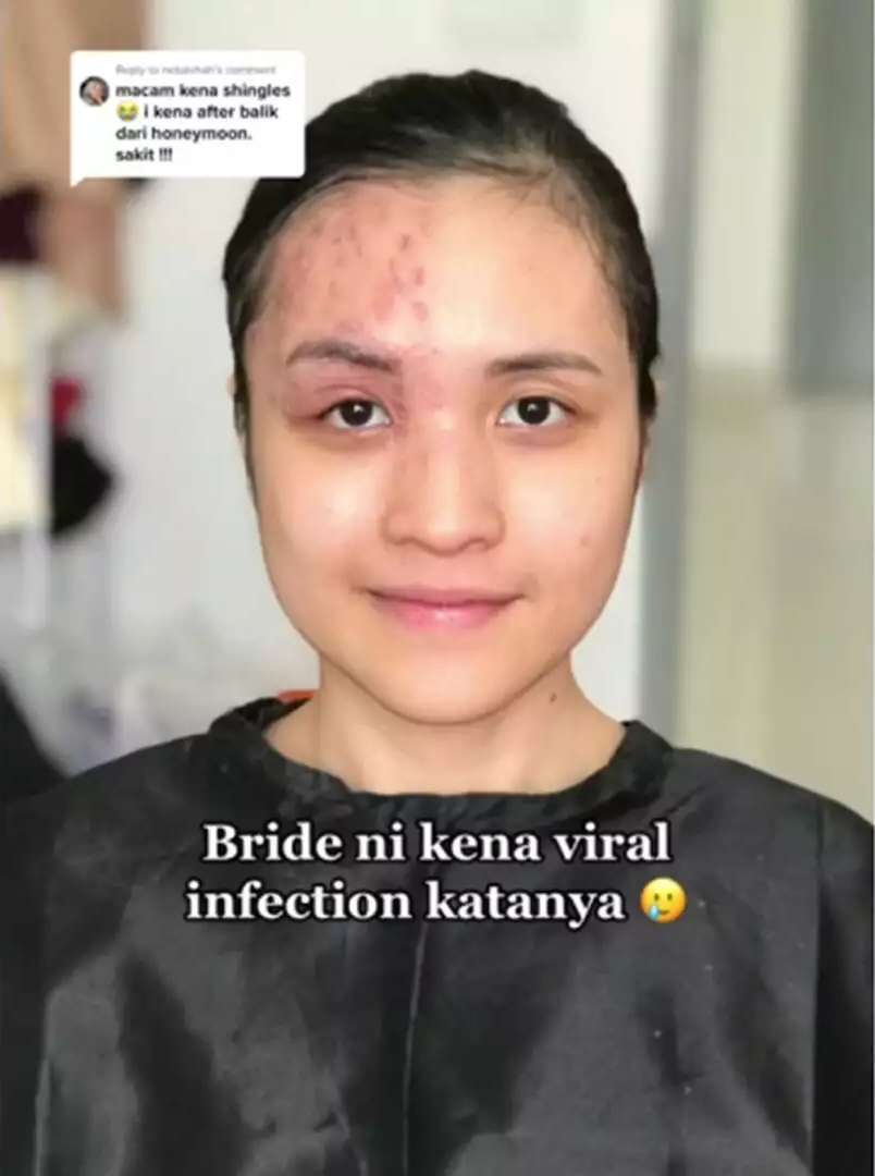 Potret Pengantin Wajahnya Terkena Infeksi Dirias MUA, Hasilnya Bikin Pangling, Mulus Bak Barbie Hidup!
