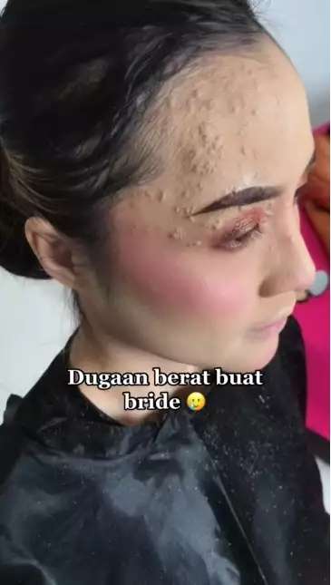 Potret Pengantin Wajahnya Terkena Infeksi Dirias MUA, Hasilnya Bikin Pangling, Mulus Bak Barbie Hidup!