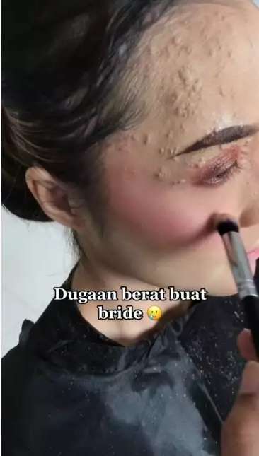 Potret Pengantin Wajahnya Terkena Infeksi Dirias MUA, Hasilnya Bikin Pangling, Mulus Bak Barbie Hidup!