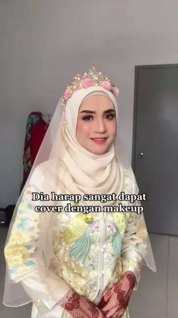 Potret Pengantin Wajahnya Terkena Infeksi Dirias MUA, Hasilnya Bikin Pangling, Mulus Bak Barbie Hidup!