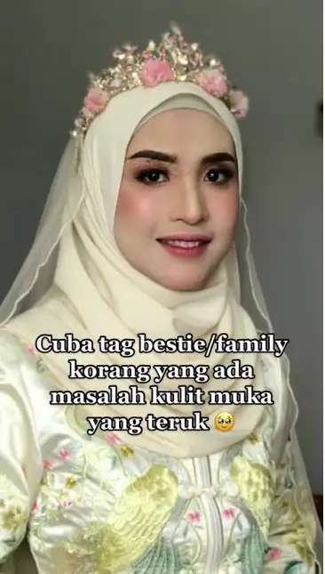 Potret Pengantin Wajahnya Terkena Infeksi Dirias MUA, Hasilnya Bikin Pangling, Mulus Bak Barbie Hidup!