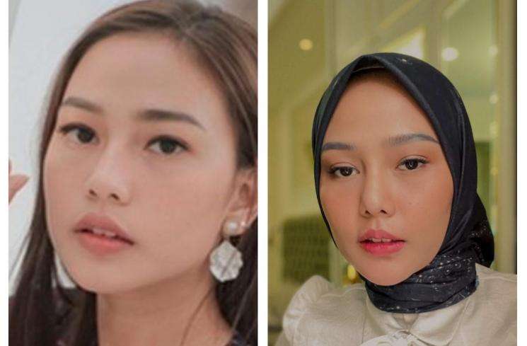 Beda Banget dan Manglingin! Foto Artis Sebelum dan Sesudah Oplas