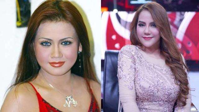 Beda Banget dan Manglingin! Foto Artis Sebelum dan Sesudah Oplas